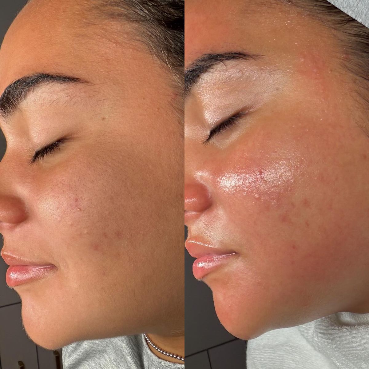 bb5f1a49f9b18c560d70af3592906a59